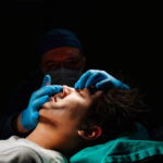 Quel est le rôle des greffes cartilagineuses dans une rhinoplastie à Lyon ?